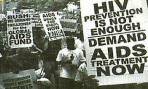 HIV